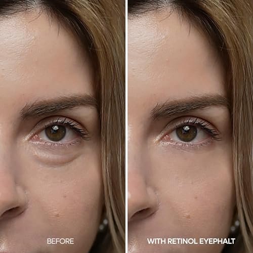Dr.Melaxin Retinol Eyebag Cream – Puffiness, Dark Circles & Fine Lines Treatment with EGF, Niacinamide & Ceramide, 0.35 Fl Oz Avelisse