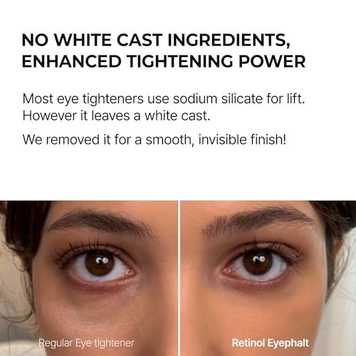 Dr.Melaxin Retinol Eyebag Cream – Puffiness, Dark Circles & Fine Lines Treatment with EGF, Niacinamide & Ceramide, 0.35 Fl Oz Avelisse