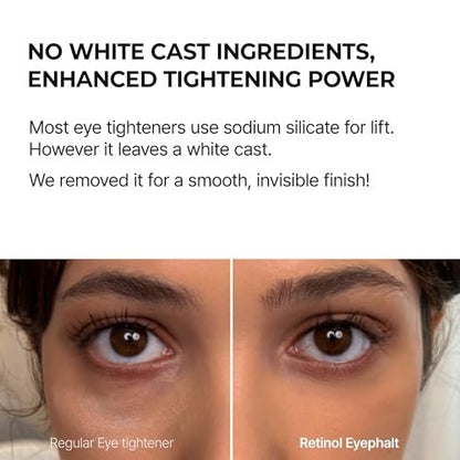 Dr.Melaxin Retinol Eyebag Cream – Puffiness, Dark Circles & Fine Lines Treatment with EGF, Niacinamide & Ceramide, 0.35 Fl Oz Avelisse
