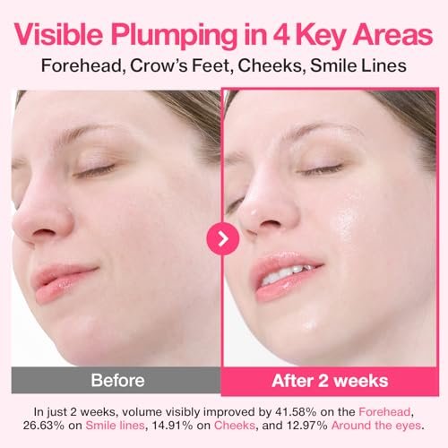 numbuzin No.2 Rose PDRN Collagen Plumping Serum - Hydrating & Firming Serum with Peptides for Plump, Glowing Skin - Korean Skincare, 1.01 fl oz (30ml) Avelisse