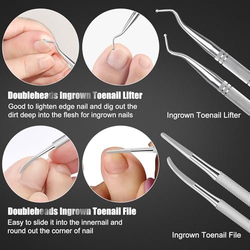 Professional 7-Piece Ingrown Toenail Treatment Set – Stainless Steel Removal Kit for Thick & Ingrown Nails Avelisse