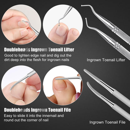 Professional 7-Piece Ingrown Toenail Treatment Set – Stainless Steel Removal Kit for Thick & Ingrown Nails Avelisse