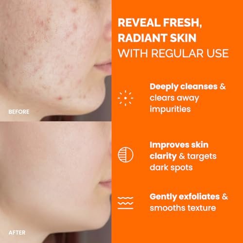 PLANTIFIQUE Kojic Acid and Turmeric Pads for Dark Spots – Lab Tested – 60 Face Cleansing Pads with Ceramides, Niacinamide & Vitamin C Avelisse