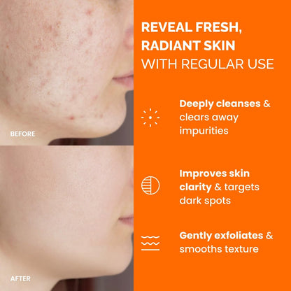 PLANTIFIQUE Kojic Acid and Turmeric Pads for Dark Spots – Lab Tested – 60 Face Cleansing Pads with Ceramides, Niacinamide & Vitamin C Avelisse