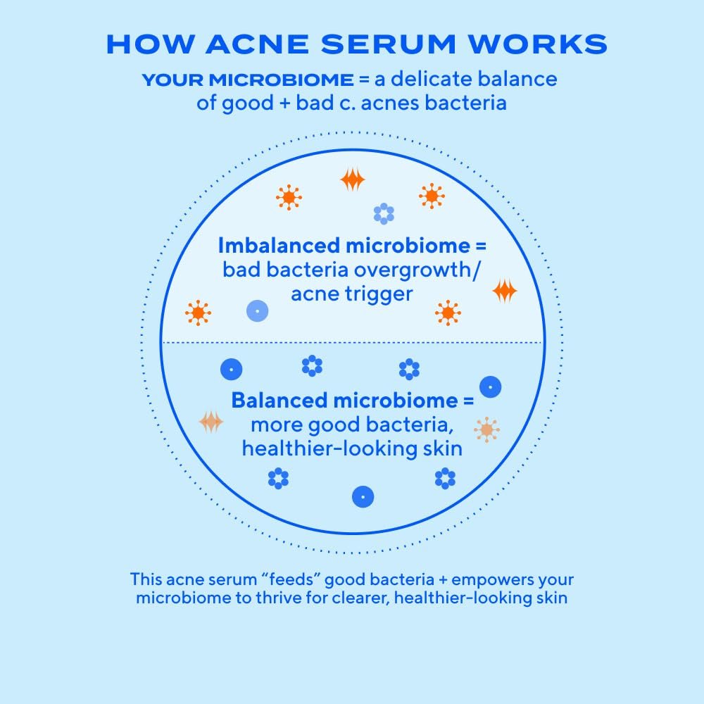 Murad Biome-Balancing Acne Treatment – Salicylic, Mandelic & Glutamic Acid Serum for Clearing Breakouts, Decongesting Pores & Balancing Skin Microbiome – 1.0 Fl Oz Avelisse