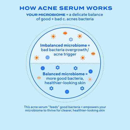 Murad Biome-Balancing Acne Treatment – Salicylic, Mandelic & Glutamic Acid Serum for Clearing Breakouts, Decongesting Pores & Balancing Skin Microbiome – 1.0 Fl Oz Avelisse