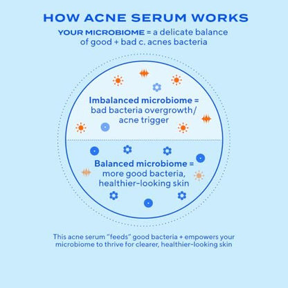 Murad Biome-Balancing Acne Treatment – Salicylic, Mandelic & Glutamic Acid Serum for Clearing Breakouts, Decongesting Pores & Balancing Skin Microbiome – 1.0 Fl Oz Avelisse