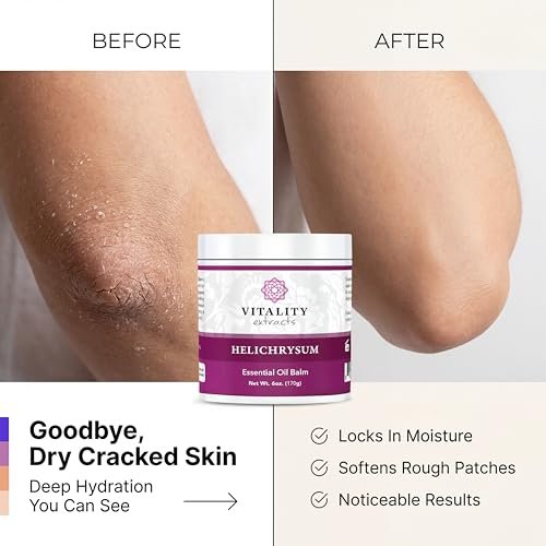 Vitality Extracts Helichrysum Balm - 6oz, Helichrysum Gymnocephalum, Beeswax, Almond Oil, Ultra-Moisturizing Skin Healing Full Body Hydration Avelisse
