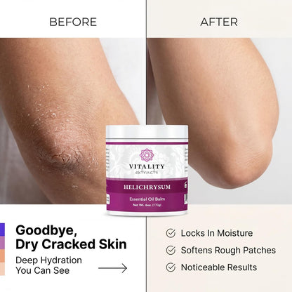 Vitality Extracts Helichrysum Balm - 6oz, Helichrysum Gymnocephalum, Beeswax, Almond Oil, Ultra-Moisturizing Skin Healing Full Body Hydration Avelisse