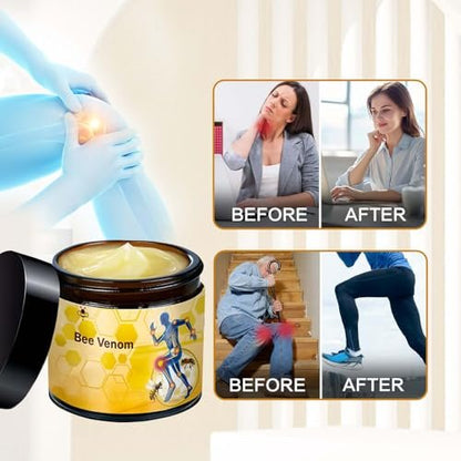 MILEDY Bee Venom Cream (2-Pack) – Professional Strength for Back, Knee, Hands, Neck & Feet Avelisse
