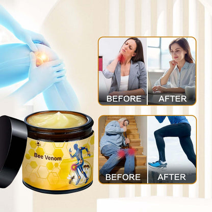 MILEDY Bee Venom Cream (2-Pack) – Professional Strength for Back, Knee, Hands, Neck & Feet Avelisse
