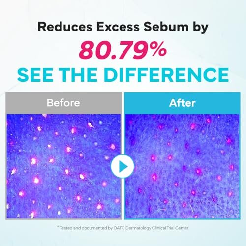 SAM'U Galacto Pore Water Full Cleansing Oil - Korean Oil Cleanser & Makeup Remover with Galactomyces & Rice Bran Oil, Non-Comedogenic, 6.76 fl oz - görsel 8