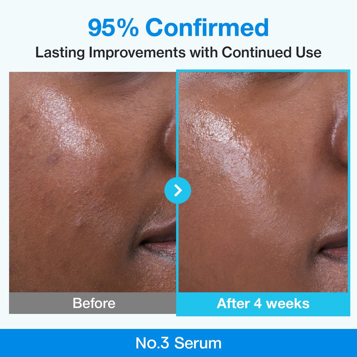 numbuzin No.3 Blue Bio-Retinol Pore Refining Serum – Retinol Beginner, Tightening, Firming, BHA, Niacinamide, Peptide – 1.01 fl oz (30ml) Avelisse
