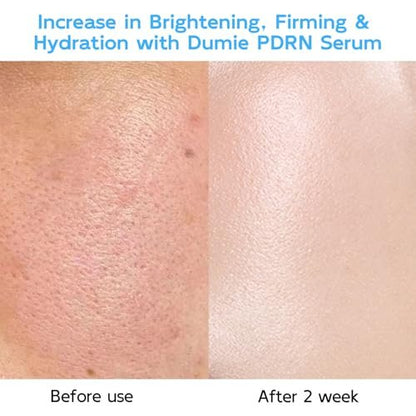 Salmon DNA PDRN Anti-Aging Serum – 5000ppm Salmon Egg DNA Ampoule with Collagen, Glutathione, Niacinamide & 6 Hyaluronic Acids – Korean Skincare for Wrinkles & Radiance (0.05 fl oz x 30) Avelisse