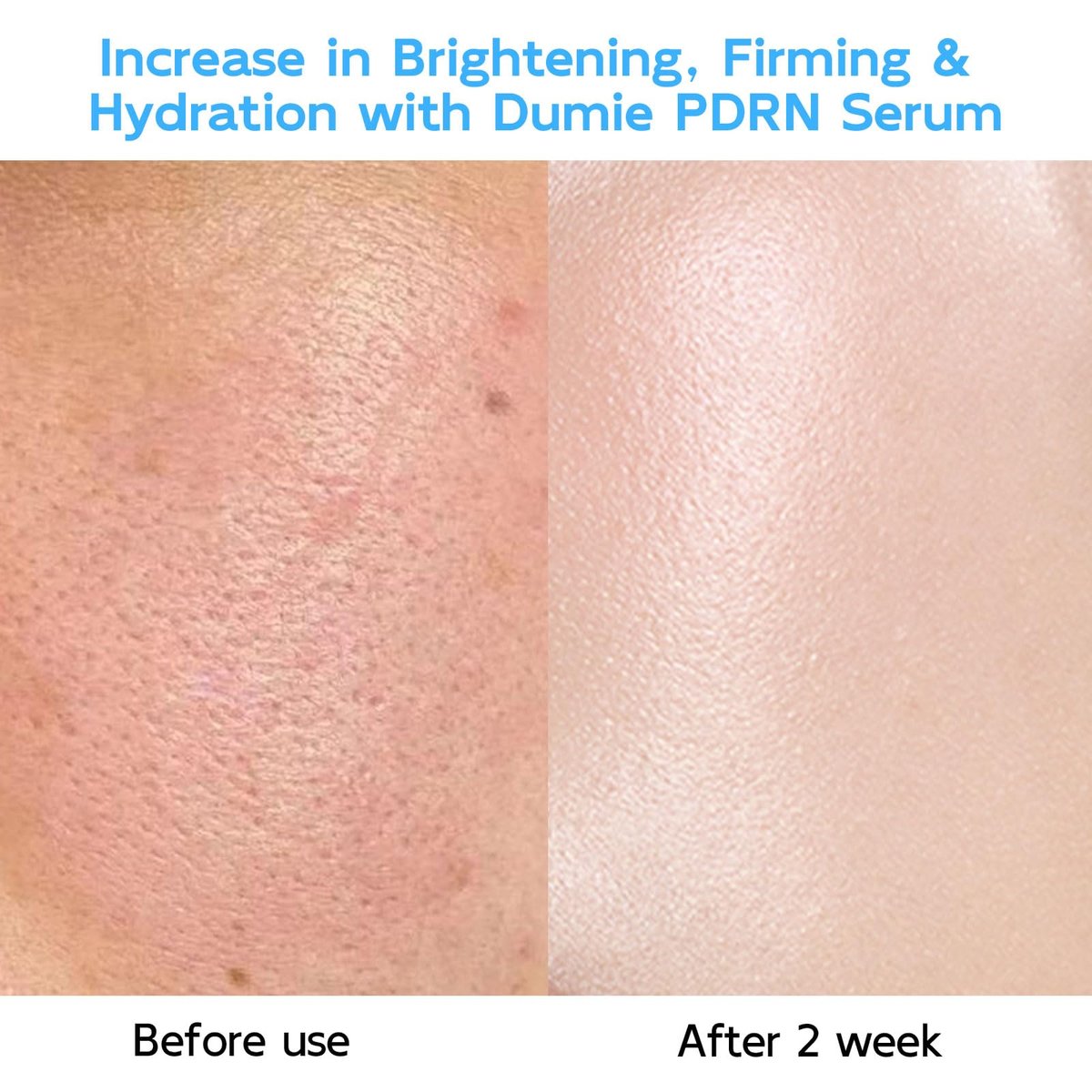 Salmon DNA PDRN Anti-Aging Serum – 5000ppm Salmon Egg DNA Ampoule with Collagen, Glutathione, Niacinamide & 6 Hyaluronic Acids – Korean Skincare for Wrinkles & Radiance (0.05 fl oz x 30) Avelisse