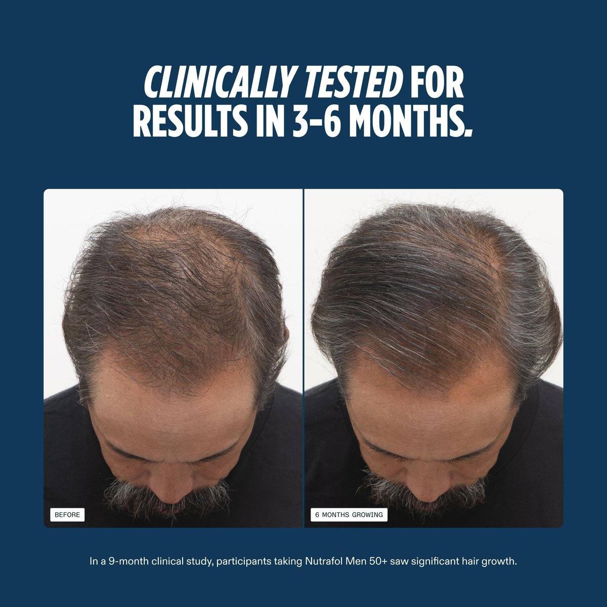 Nutrafol Men 50+ Hair Growth Supplements - Clinically Tested for Thicker Hair & Scalp Coverage, #1 Dermatologist-Recommended - 1 Month Supply Avelisse