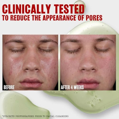 Thayers Oil Balancing and Cooling Jelly Toner – Pore Reducing Facial Toner for Combination to Oily Skin, 12 Fl Oz