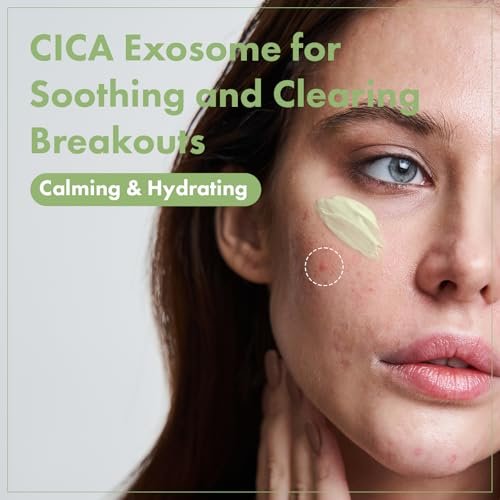 TOSOWOONG Exosome CICA Face Cream - Daily Soothing Moisturizer for Breakouts and Irritated Skin, Fast-Acting, Lightweight Korean Skincare for Redness and Blemish-Prone Skin, 50ml / 1.69 fl. oz. Avelisse