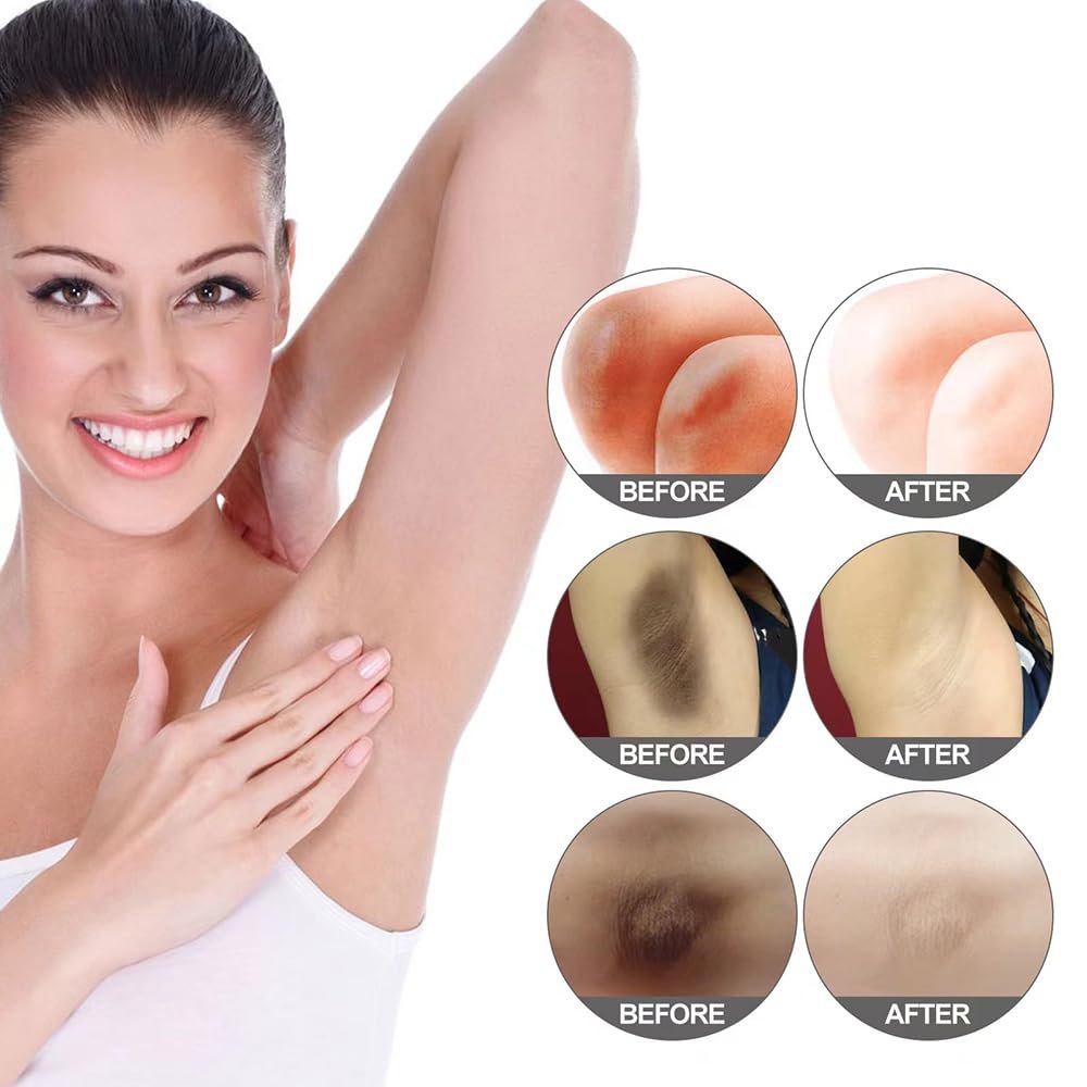 Yeweian Brightening Cream for Underarms & Intimate Areas - Dark Spot Remover for Face, Neck, Elbows, Inner Thighs & Knees - 1.69 Fl Oz - görsel 11