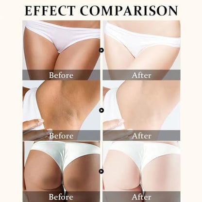 Yeweian Brightening Cream for Underarms & Intimate Areas - Dark Spot Remover for Face, Neck, Elbows, Inner Thighs & Knees - 1.69 Fl Oz