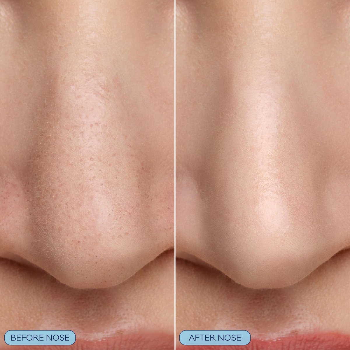 Bioré Pore Refining Bubbling Nose Mask with Glycolic Acid and Hyaluronic Acid – Deep Pore Cleansing Exfoliating Mask, 8 Ct - görsel 5