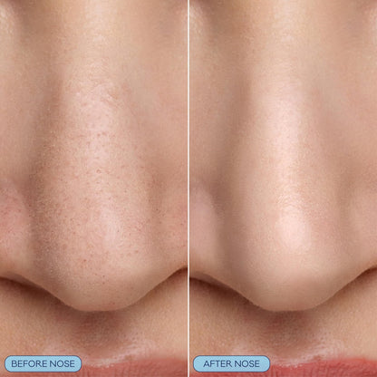 Bioré Pore Refining Bubbling Nose Mask with Glycolic Acid and Hyaluronic Acid – Deep Pore Cleansing Exfoliating Mask, 8 Ct