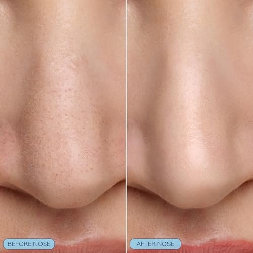 Bioré Pore Refining Bubbling Nose Mask with Glycolic Acid and Hyaluronic Acid – Deep Pore Cleansing Exfoliating Mask, 8 Ct - görsel 6