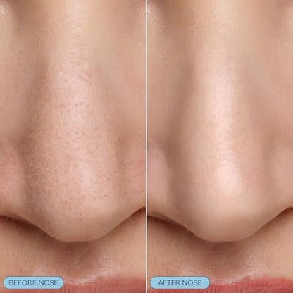 Bioré Pore Refining Bubbling Nose Mask with Glycolic Acid and Hyaluronic Acid – Deep Pore Cleansing Exfoliating Mask, 8 Ct
