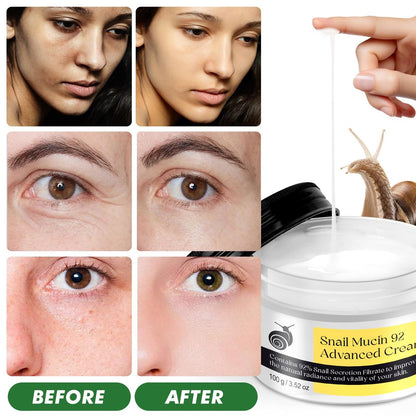 Snail Mucin Serum & Moisturizer – Daily Face Serum for All Skin Types, 3.52 oz Avelisse