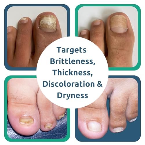 Dr. Blaine's Tineacide Nail Renewal Gel – Softens, Hydrates & Improves Appearance of Thick, Brittle & Discolored Nails – Targets Cracking & Yellowing – Includes Precision Clippers – 1.25 fl oz Avelisse