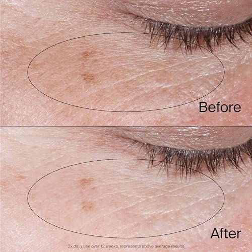 Neutrogena Collagen Bank Reviving Eye Cream - Under Eye Cream with Peptides, Helps Preserve Collagen, Visibly Improves Dark Circles, Puffiness, Fine Lines & Texture, Fragrance Free, 0.5 oz - görsel 10