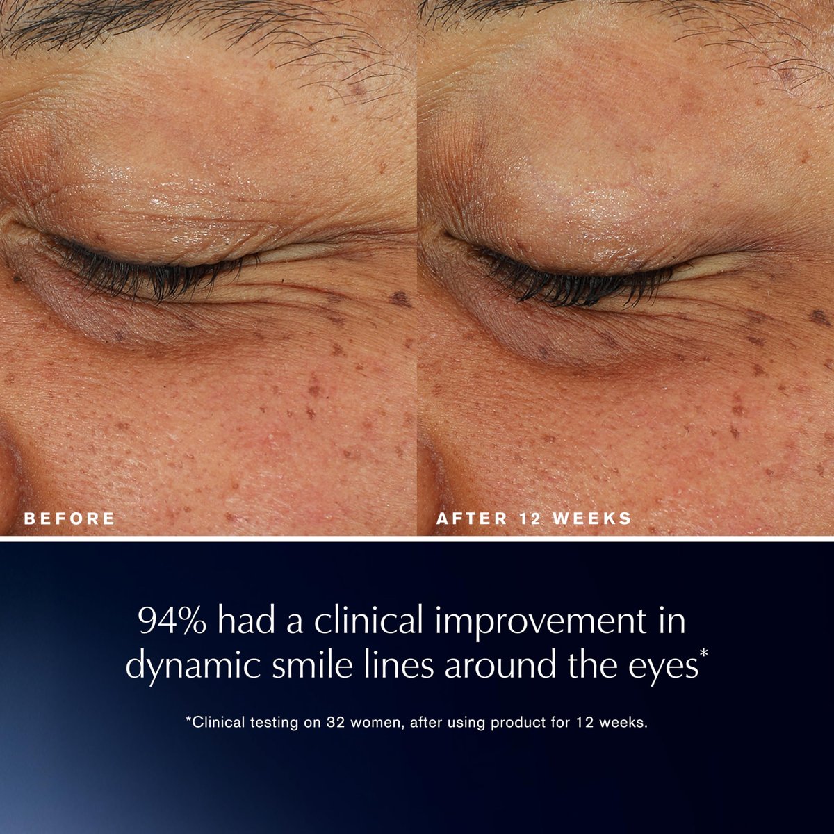 Estée Lauder Advanced Night Repair Eye Lift + Sculpt | Eye Cream with 2HA Volume Filler & Hexapeptide-8, 0.5 Fl Oz Avelisse