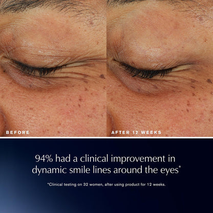 Estée Lauder Advanced Night Repair Eye Lift + Sculpt | Eye Cream with 2HA Volume Filler & Hexapeptide-8, 0.5 Fl Oz Avelisse