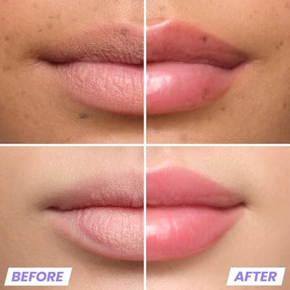 Wonderskin Lip Plumper Gloss - Lip Relapse Plumping Gloss for Fuller-Looking, Hydrating, Non-Sticky High-Shine Finish Avelisse