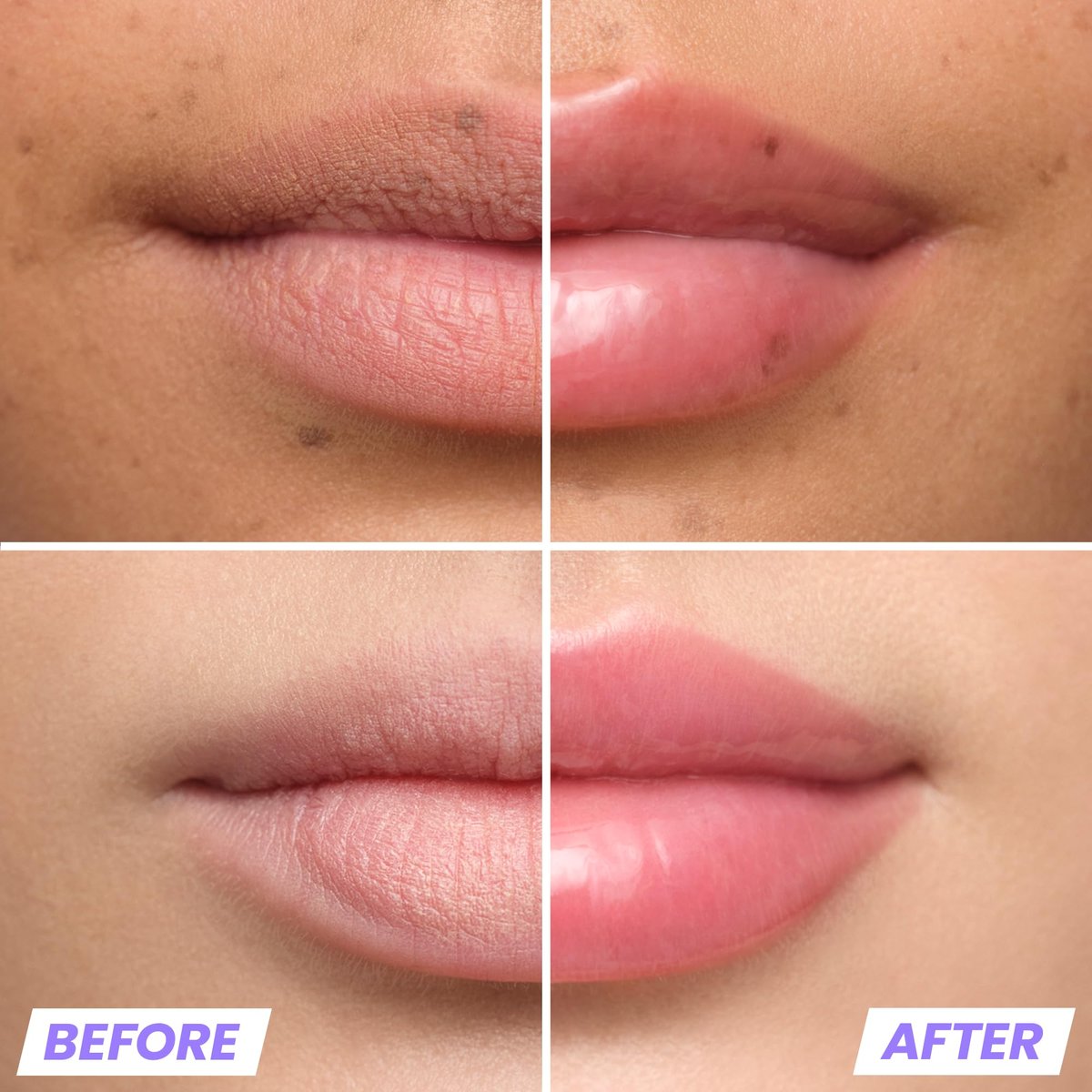 Wonderskin Lip Plumper Gloss - Lip Relapse Plumping Gloss for Fuller-Looking, Hydrating, Non-Sticky High-Shine Finish Avelisse