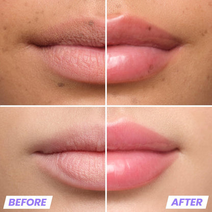 Wonderskin Lip Plumper Gloss - Lip Relapse Plumping Gloss for Fuller-Looking, Hydrating, Non-Sticky High-Shine Finish Avelisse