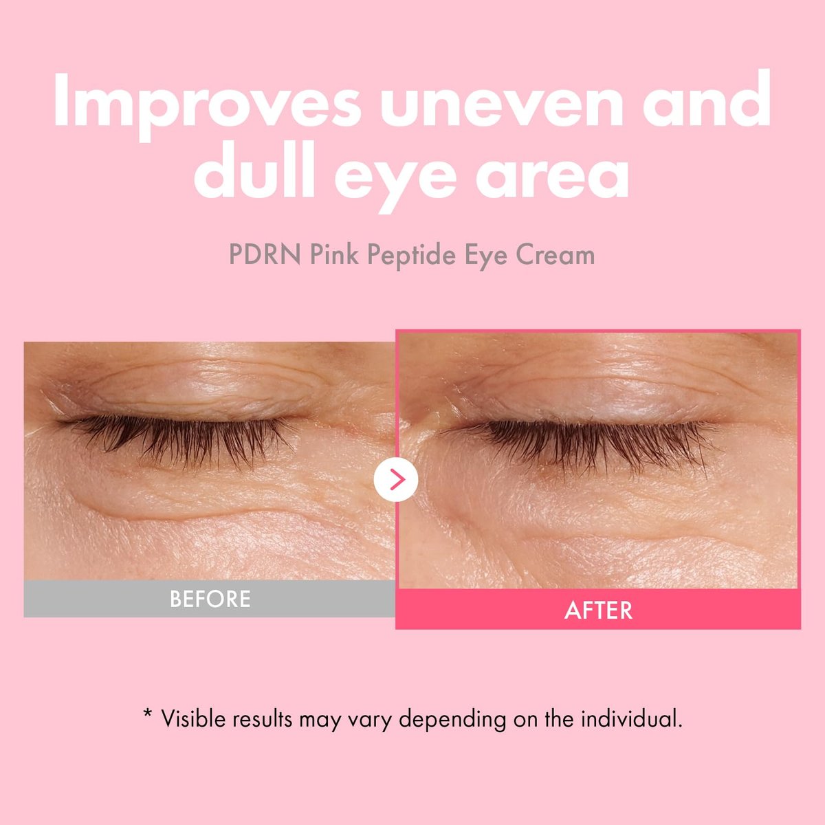 TOSOWOONG PDRN Pink Peptide Eye Cream with Salmon DNA PDRN 5,000ppm – Anti-Aging Eye Treatment with Caffeine & Liposome Retinol for Fine Lines, Dark Circles & Wrinkles – Korean Skincare, 30ml Avelisse