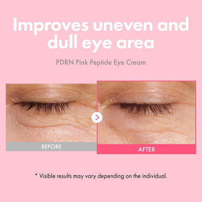 TOSOWOONG PDRN Pink Peptide Eye Cream with Salmon DNA PDRN 5,000ppm – Anti-Aging Eye Treatment with Caffeine & Liposome Retinol for Fine Lines, Dark Circles & Wrinkles – Korean Skincare, 30ml Avelisse