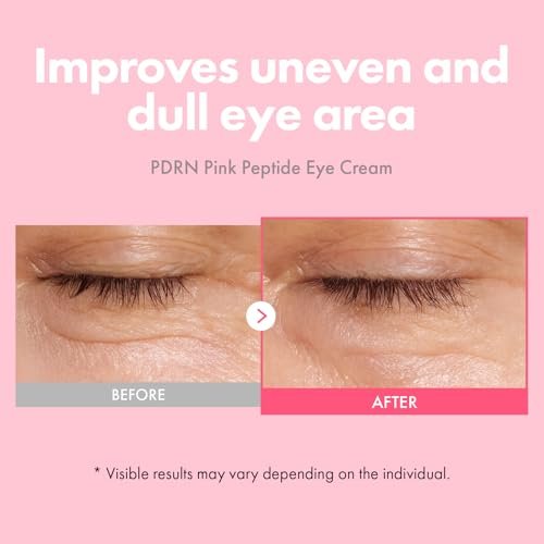 TOSOWOONG PDRN Pink Peptide Eye Cream with Salmon DNA PDRN 5,000ppm – Anti-Aging Eye Treatment with Caffeine & Liposome Retinol for Fine Lines, Dark Circles & Wrinkles – Korean Skincare, 30ml Avelisse