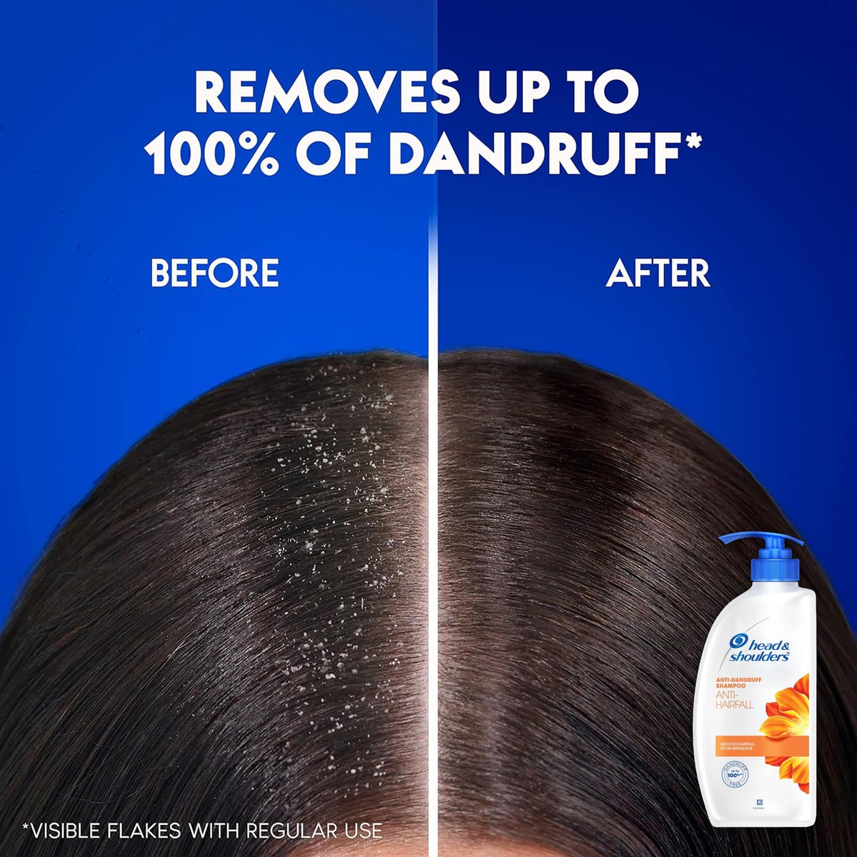 Head & Shoulders Anti Hair Fall Shampoo, 2 Pack Anti Dandruff Shampoo, Relieves Dry Scalp and Repairs Damage, Fresh Scent, 22 oz Pump Bottles Avelisse