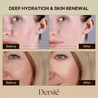 Dersie Cream with Magnesium and Tallow - Honey Tallow Balm, 2.12 oz - Face Moisturizer Avelisse