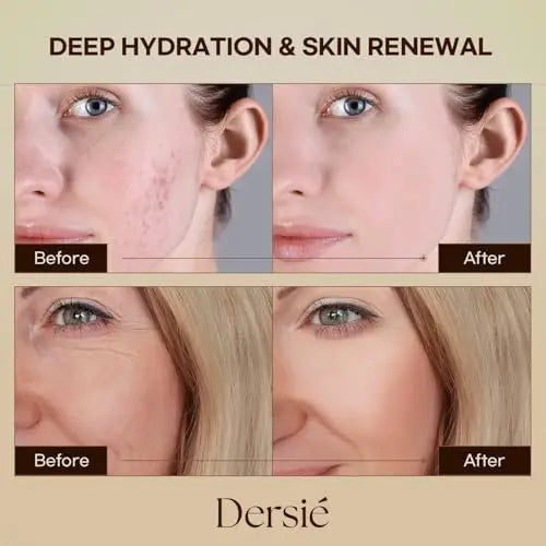 Dersie Cream with Magnesium and Tallow - Honey Tallow Balm, 2.12 oz - Face Moisturizer Avelisse