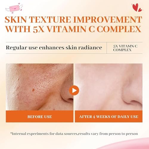 Vitamin C Face Toner 130ml – HONLINK 5X Vitamin C Complex with Niacinamide & Hyaluronic Acid, Hydrating & Balancing Daily Skincare Toner Avelisse