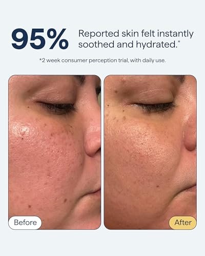 Remedy for Light Moisture | Barrier Repairing Hydrating Lightweight Gel Moisturizer Water Cream for Normal to Oily Skin | By Dermatologist Dr. Shah, 1.7 fl. Oz Avelisse