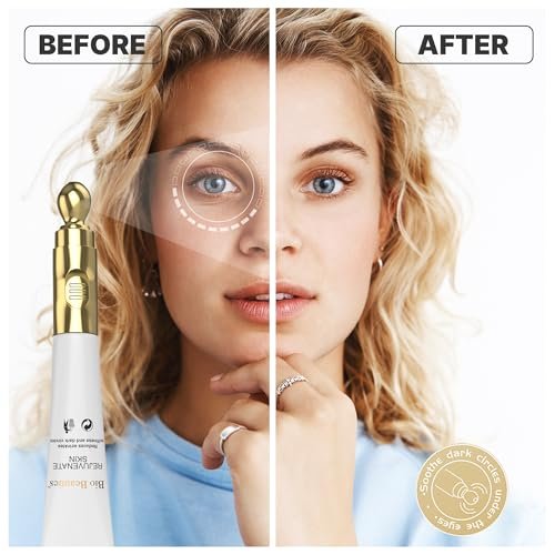 Retinol Under Eye Cream with Electric Massager - Hydrating Anti-Aging Eye Cream to Reduce Dark Circles, Wrinkles & Puffiness for Men & Women Avelisse