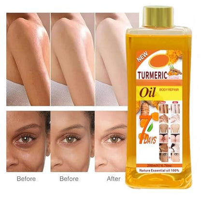 Gtrwadd Turmeric Oil for Skin - Natural Moisturizing Nourishing Face & Body Oil with Vitamin E - 6.76 Fl Oz