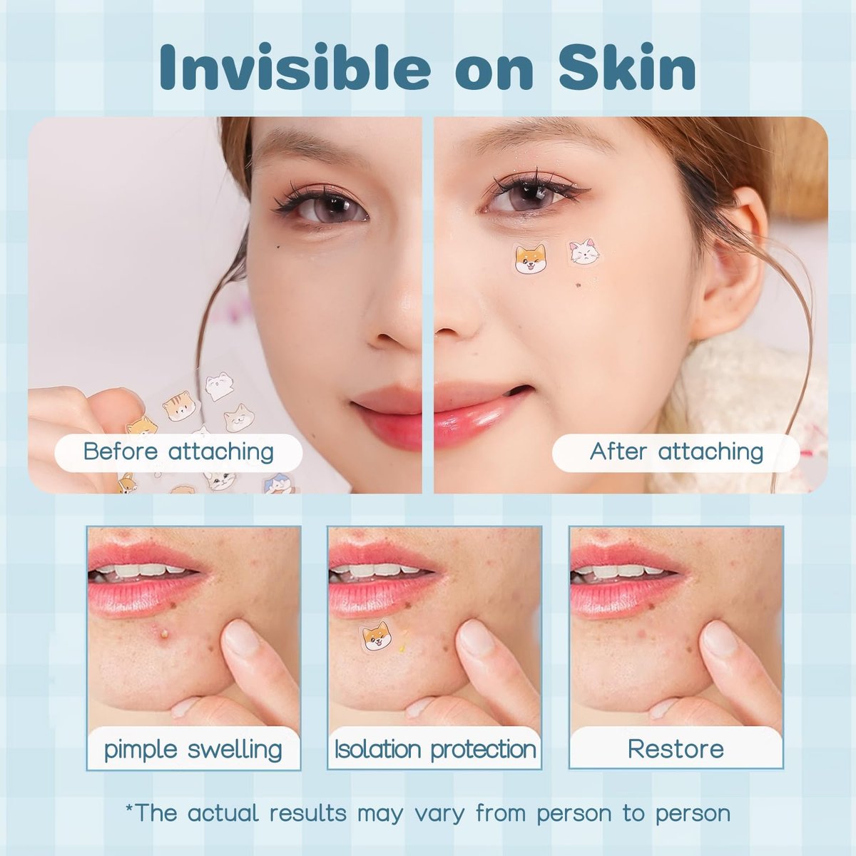 VENROCK Pimple Patches for Face – 48 Count Hydrocolloid Acne Treatment with Cute Pet Shapes, Salicylic Acid, Tea Tree Oil & Centella Asiatica – Fun Acne Spot Stickers for Kids & Adults - görsel 11