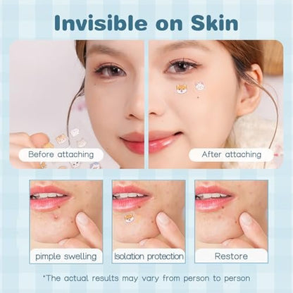 VENROCK Pimple Patches for Face – 48 Count Hydrocolloid Acne Treatment with Cute Pet Shapes, Salicylic Acid, Tea Tree Oil & Centella Asiatica – Fun Acne Spot Stickers for Kids & Adults