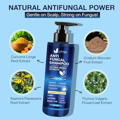 Uttse Anti-Fungal Shampoo for Scalp Psoriasis, Dandruff, Folliculitis & Seborrheic Dermatitis – Relieves Itchy & Dry Scalp – 300 mL / 10.1 fl.oz Avelisse