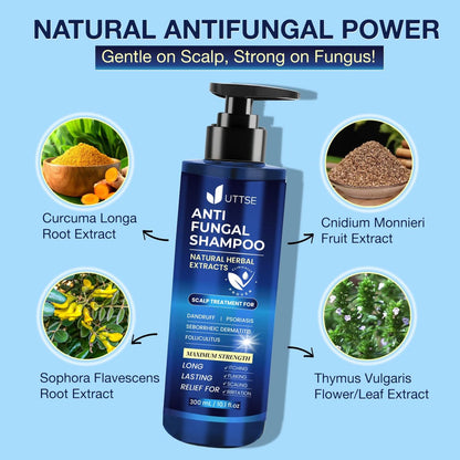 Uttse Anti-Fungal Shampoo for Scalp Psoriasis, Dandruff, Folliculitis & Seborrheic Dermatitis – Relieves Itchy & Dry Scalp – 300 mL / 10.1 fl.oz Avelisse